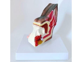 Image 1 of 9