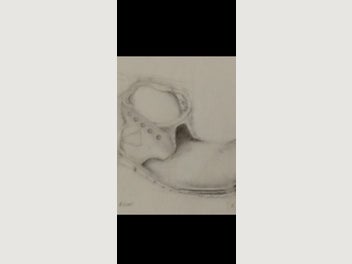 Image 1 of 13
