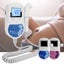 New Fetal Doppler Afterpay Carousel 4