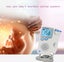 Fetal Doppler - (NZ CLEARANCE) Carousel 6
