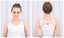 ObboMed Shoulder Posture Brace One Size Fits All MB-3050N Carousel 1