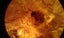 Kauri Gum 10 Insect Inclusions Time Capsule. Carousel 5