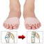 1 Pair Magic Silicone Gel Open-toed Toe Pads Foot Care Tool Massaging M Carousel 2