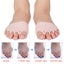 1 Pair Magic Silicone Gel Open-toed Toe Pads Foot Care Tool Massaging M Carousel 5