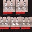 Eyeglasses Sunglasses Repair Kit, Balloon Soft Silicone Nose Pads Support Replac Carousel 2