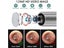 PTN New Ear Endoscope Sale Sale Sale Carousel 6