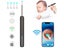 PTN New Ear Endoscope Sale Sale Sale Carousel 8