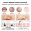 Vacuum Pore Cleaner Blackhead Remover Electric Acne Exfoliating USB NEW Carousel 3