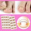 Toe nail Corrector Stickers Paronychia Treatment Pedicure Toe Nail Carousel 3