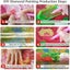 5D Diamond Painting Diamond Art Kits I1800GW0 Carousel 11