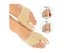 2Pcs Bunion Corrector Orthopedic Straightener Adjuster Brace Foot Toe Separator Carousel 2