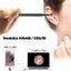 Ear Cleaning Endoscope Visual Camera Picker Medical Otoscope i2025BK0 Carousel 6