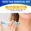 Skin Tag Remover 2-in-1 Tool Kit i2367LB0 Carousel 13