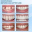 Tooth Repair Glue Shapeable Temporary Teeth Gap Filling Repair i2434MZ0 Carousel 6