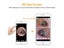 Endoscope Carousel 2