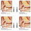 Visible Earpick Medical Otoscope Waterproof Camera Earwax Visual Oral Ins CHK12N Carousel 6