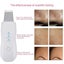 Ultrasonic Vibrate Rechargeable Skin Scrubber Face Cleaning Machine Facial Carousel 5