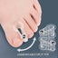 2pcs Bunion Hallux Valgus Toe Spreader Separator Thumb Finger Correction Tool Carousel 3