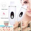 Ultrasonic Blackhead Remover Vacuum Deep Facial Cleansing Remover Pimple Use B Carousel 1