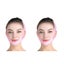 V Face Mask - 2packs Carousel 6