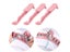 Knitting Machine Replacement Needles 5 Pack For Needle Knitting Machine Parts Carousel 3