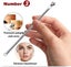 5 Pack Blackhead Remover Kit Pimple Tool Set For Acne Treatment Carousel 3