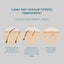 IPL Laser Home Hair Removal System - High quality 990000 flashes - White Carousel 10