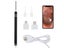 Endoscope Camera NZ Clearance Carousel 4