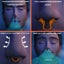 Anti Snoring Nasal Dilator Nose Breathing Nasal Congestion Prevention Or Carousel 3