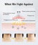 NEW Face Massager Neck Massager - NZ Stock Deal Afterpay Carousel 4