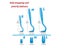 Flea Remover Hook Tick Removal Tweezer Ticks Pull Pet Cat Dog Accessaries Carousel 7