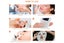 2Pcs Vacuum Blackhead Remover Facial Skin Pore Acne Pimple With 5 Suction Probes Carousel 3