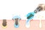 2Pcs Vacuum Blackhead Remover Facial Skin Pore Acne Pimple With 5 Suction Probes Carousel 4