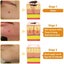 1pcs 30ml Bee Venom Treatment Cream, Tag Recede, Bee Venom Cream, for All Skin Carousel 2