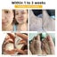 1pcs 30ml Bee Venom Treatment Cream, Tag Recede, Bee Venom Cream, for All Skin Carousel 4