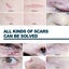 Silicone Scar Sheets Carousel 4