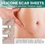 Silicone Scar Sheets Carousel 10