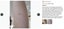Silicone Scar Sheets Carousel 12