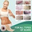Silicone Scar Sheets Carousel 5