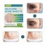 Silicone Scar Sheets Silicone Scar Tape Carousel 9