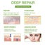 Silicone Scar Sheets Silicone Scar Tape Carousel 3
