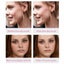 Laser Plasma Pen Tattoo Mole Freckle Spot Mole Tag Removal Skin Beauty Machine Carousel 7