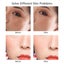 Laser Plasma Pen Tattoo Mole Freckle Spot Mole Tag Removal Skin Beauty Machine Carousel 17
