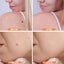 Portable Laser Freckle Dot Mole Dark Spot Tattoo Removal Pen Beauty Skin Machine Carousel 14
