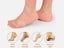 2Pairs --Foot Heel Gel Protector Painless Anti-Cracking Carousel 2