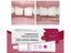 Thermoplastic Denture Adhesive Carousel 2