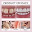 Thermoplastic Denture Adhesive Carousel 13