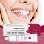 Thermoplastic Denture Adhesive Carousel 16