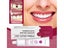 Thermoplastic Denture Adhesive Carousel 17