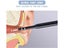PTN New Endoscope Camera Sale Sale Sale Carousel 7